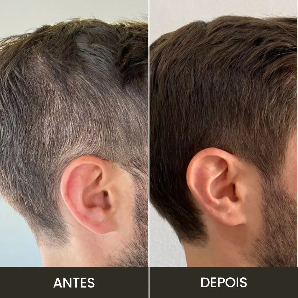 Toppik Hair: Fibra Capilar para Cobertura Instantânea